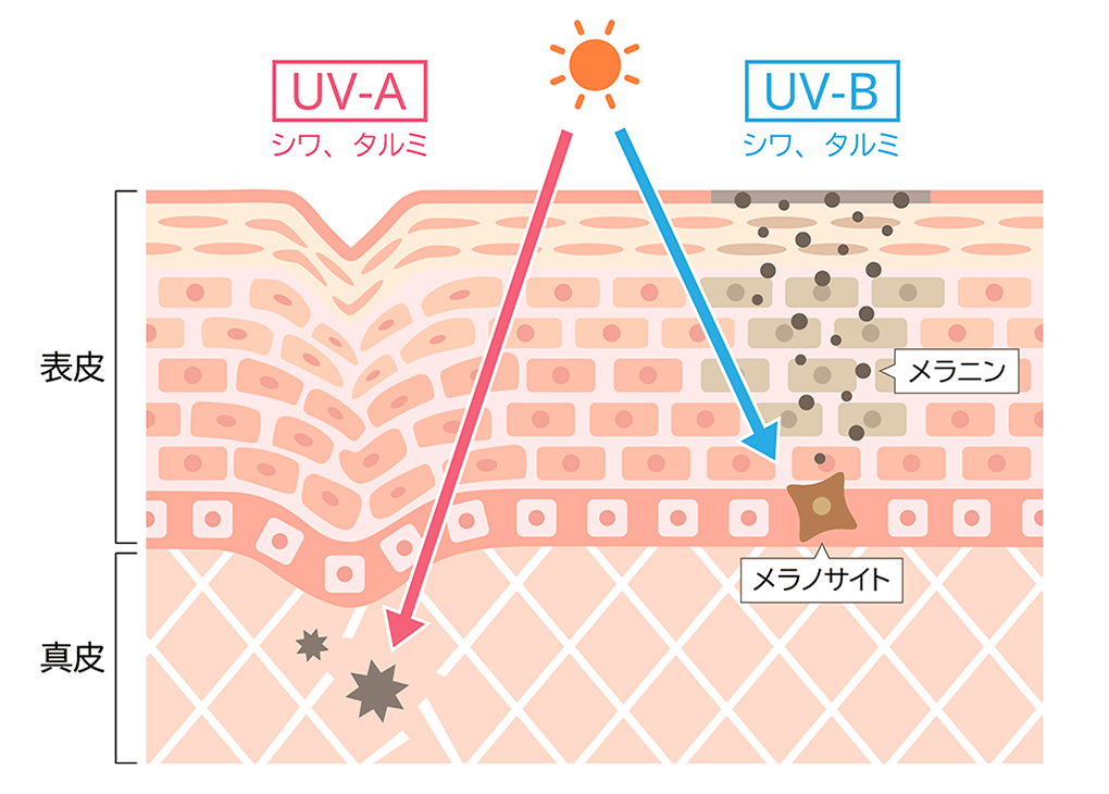 紫外線の肌への影響