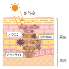 メラニンによる黒ずみ